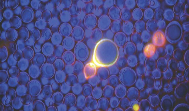 Células de levadura tratadas con resveratrol, en amarillo y más grandes, las envejecidas. SCIENCE